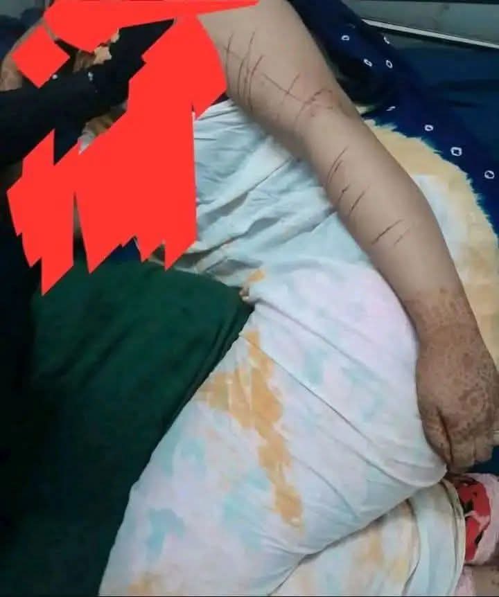 حين يُقمع الصوت باسم “السمعة”.. العروس التي ضربها زوجها