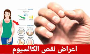 أعراض نقص الكالسيوم في الجسم: 5 علامات يجب التنبّه إليها