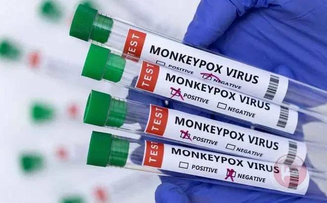 السنغال : تسجيل إصابة ثانية بجدري القردة