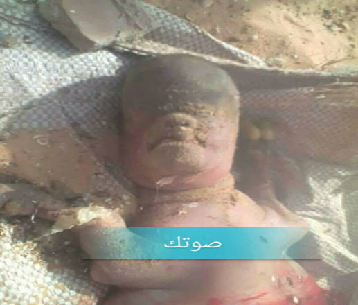 نواكشوط : معزاة تلد مخلوقا بوجه إنسان في حي ملح ( فيديو )