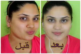 8 طرق طبيعية للتخلص من اسمرار الوجه واليدين