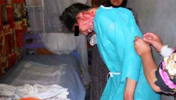 حكم بالسجن ثمانية أعوام لرجل صب الماء المغلي على وجه زوجته