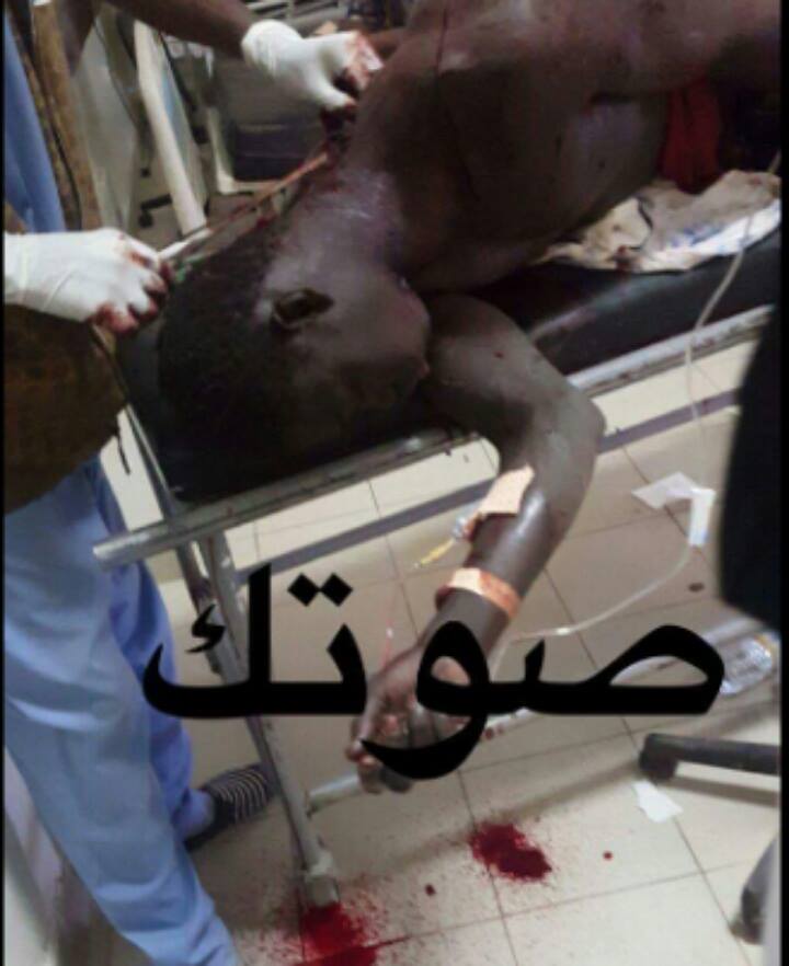 ذبح شاب في نواكشوط لسبب تافه